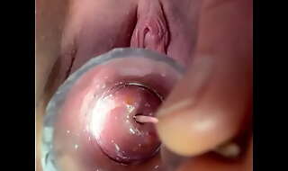 Sound moving down deep procure cervix
